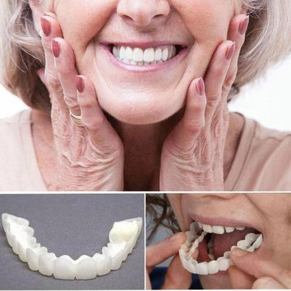 Facettes Dentaires Instant Smile – Mâchoire Supérieure et Inférieure Incluses