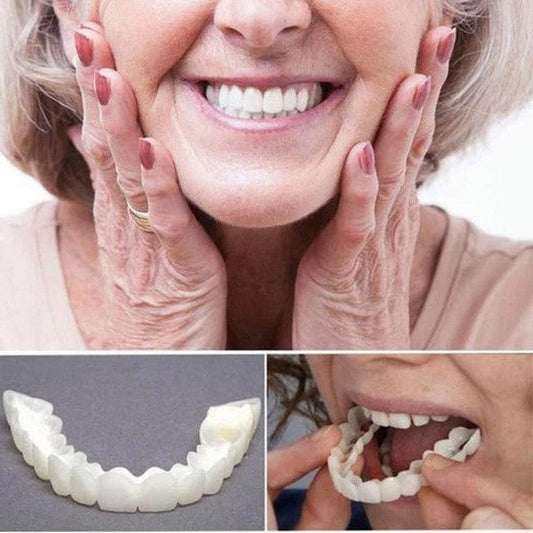 Facettes Dentaires Instant Smile – Mâchoire Supérieure et Inférieure Incluses